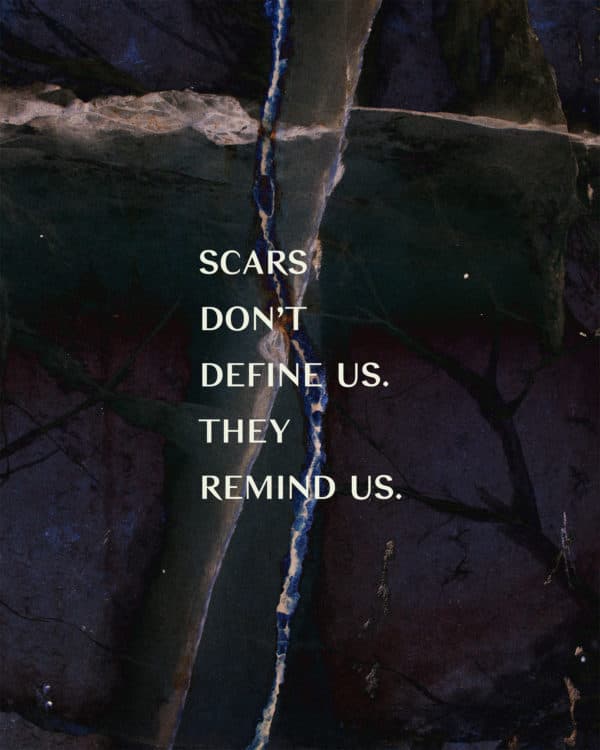 Scars don't define us. They remind us.