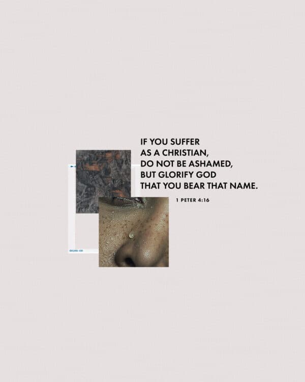 If you suffer as a Christian, do not be ashamed, but glorify God that you bear that name. - 1 Peter 4:16